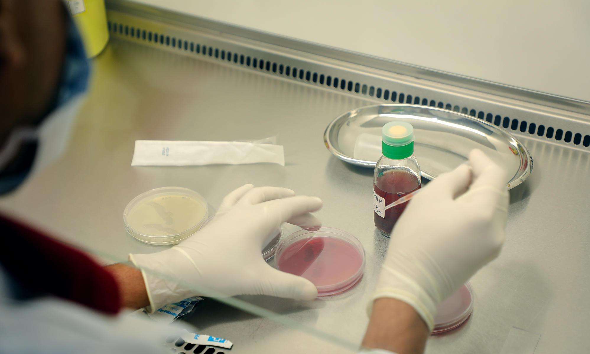 MSF bio lab at MSF’s Aden hospital