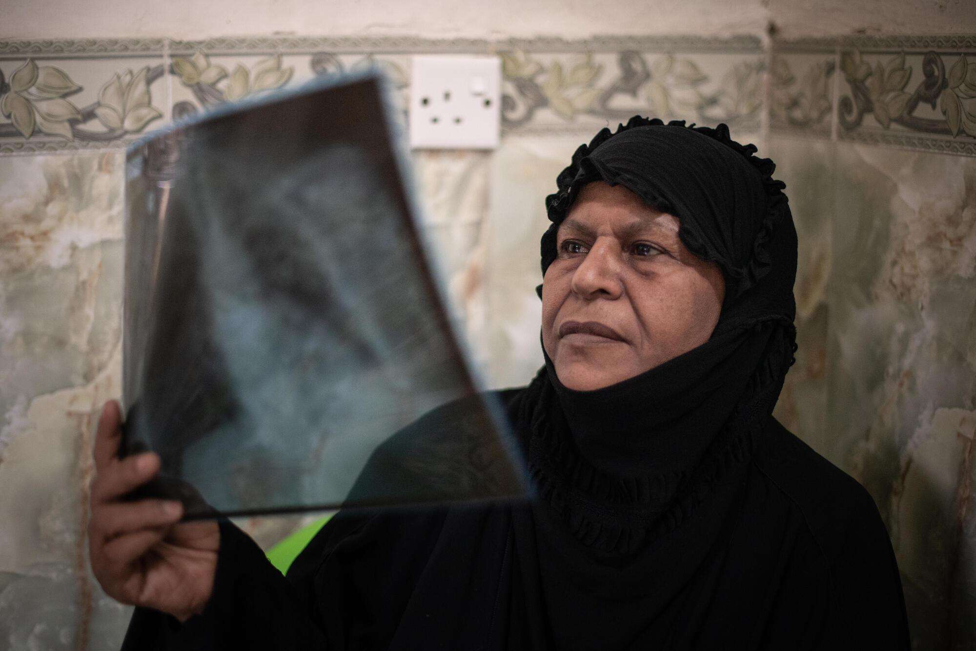 IRAQ: Tackling multidrug-resistant tuberculosis, one patient at a time