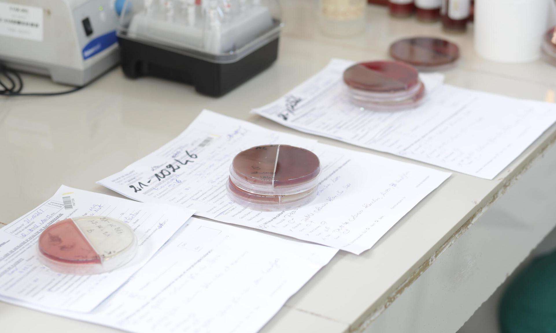 Three samples from 3 patients plated on culture media to identify bacteria in the CSREF laboratory in Koutiala, Mali.