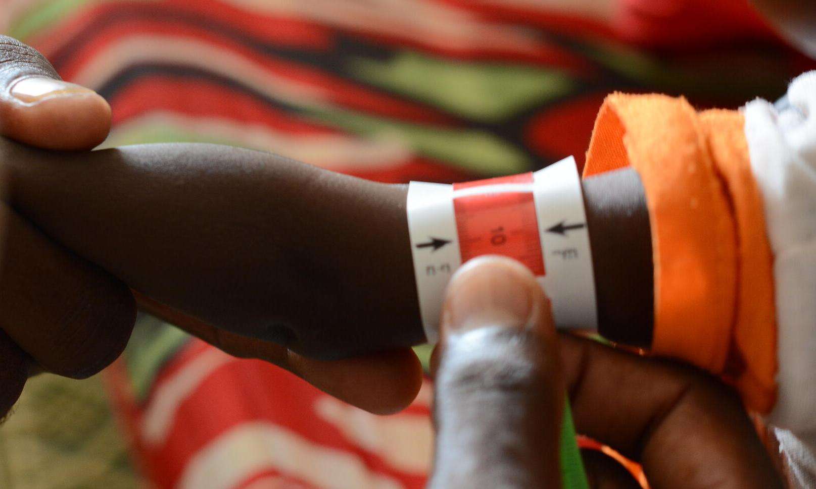 A child is screened for malnutrition in Zamzam camp, Sudan.