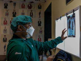 An MSF doctor in India looks at an X-ray of a lung. 