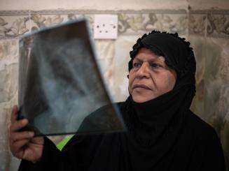 IRAQ: Tackling multidrug-resistant tuberculosis, one patient at a time