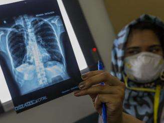 Dr. Muneeba Shaikh, a medical officer sees the results of X-ray of Rehana-28 year old, drug-resistant tuberculosis patient and participant of the endTB-Q trial at endTB clinical trial clinic in Kotri, Pakistan on Monday 29 April 2024.