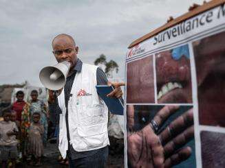 Mpox Cases Amidst Displacement Sites Near Goma