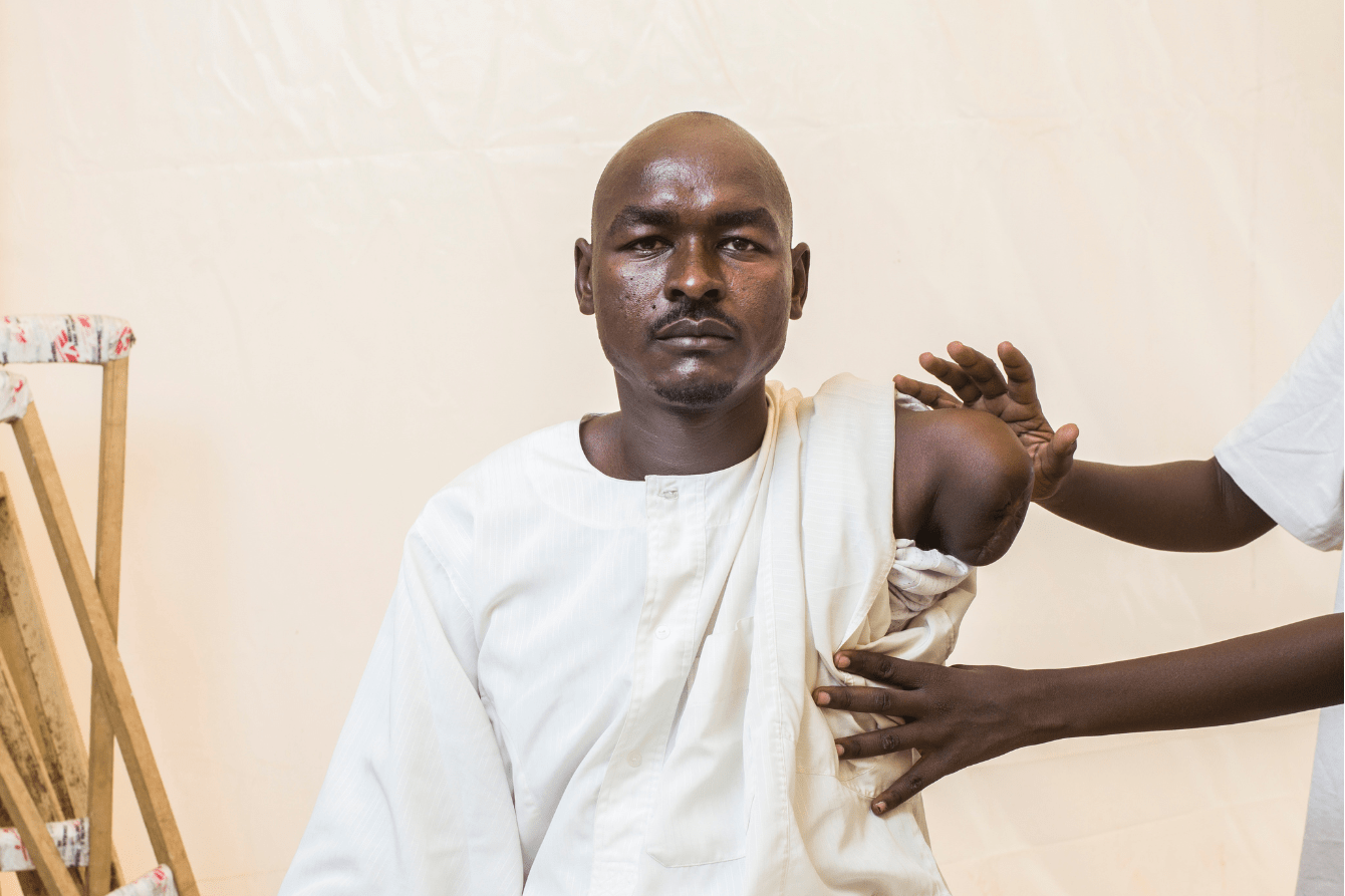 Adam, an amputee and a Sudanese refugee in Chad.