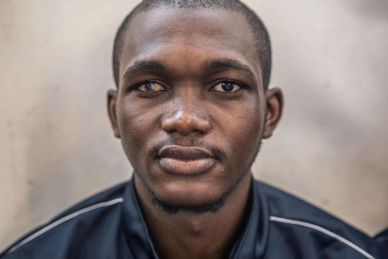 A young man with damaged eye from being tortured in a Libyan prison.