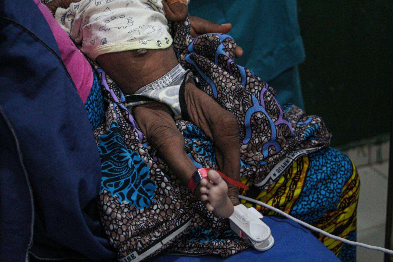 A woman holds her malnourished child in her lap in Nigeria.