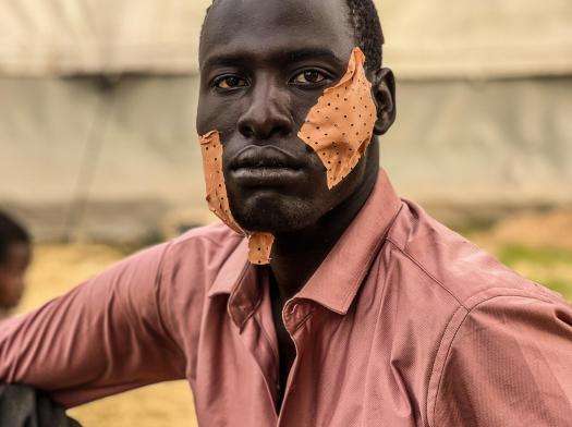 Young man from Sudan with bandaged wound on cheek after being treated by MSF aid workers in Chad