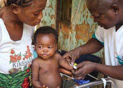 A child is treated for measles in DRC. 