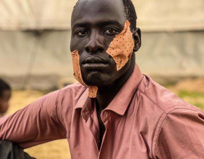 Young man from Sudan with bandaged wound on cheek after being treated by MSF aid workers in Chad