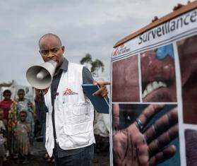 Mpox Cases Amidst Displacement Sites Near Goma