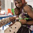 A woman holds her child while a doctor using a band to measure the child's arm to gauge their nutritional health.